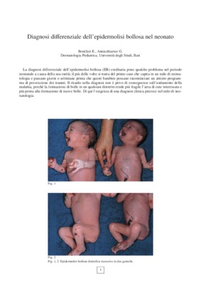 blocco differenziale Book