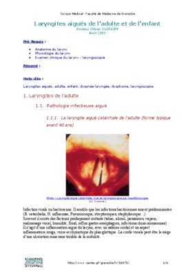 laryngites Book