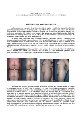 prix une liposuccion Book