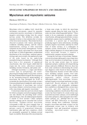 seizures Book