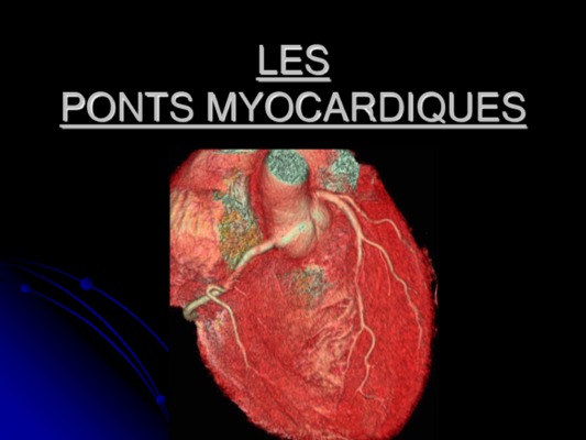 myocardiques Book