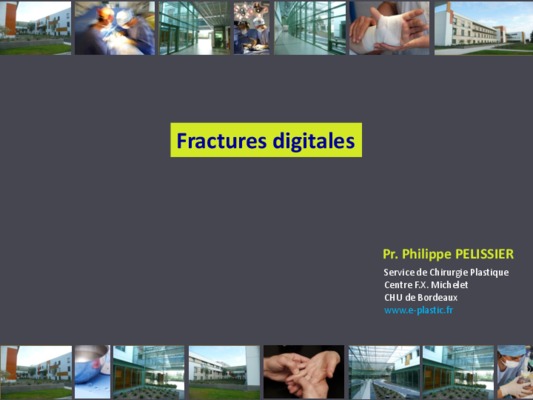 commissure Book