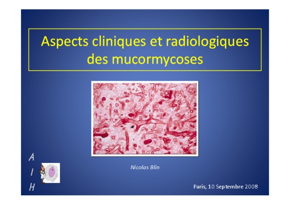 aspects cliniques et epidemiologique d_acidocetose diabetique Book