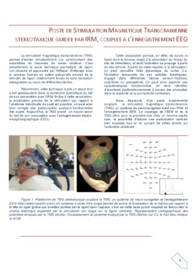 stimulation magnetique transcranienne Book