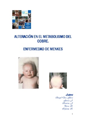 menkes Book