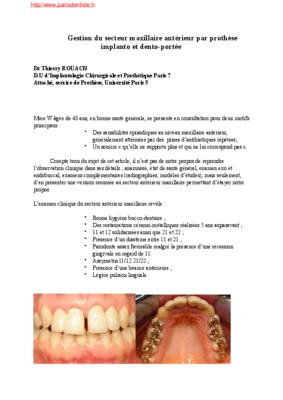 guide anterieur en prothese Book