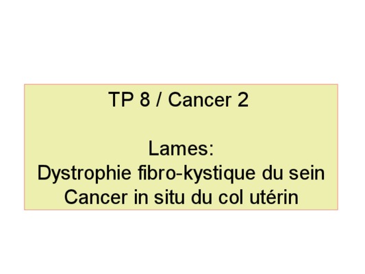 dystrophie kystique mammaire Book