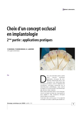 concept occlusal edente partiel Book