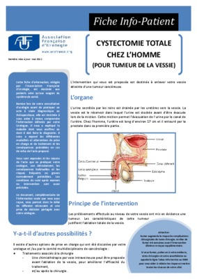 cystectomie totale Book