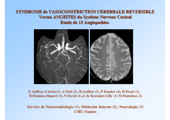 vasoconstriction Book