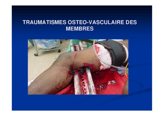 traumatismes des membres Book