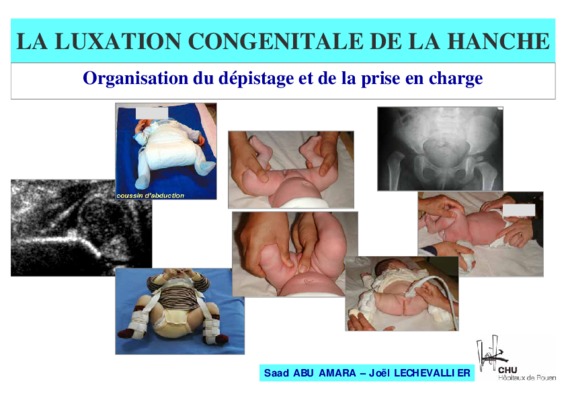 echographie de la hanche Book