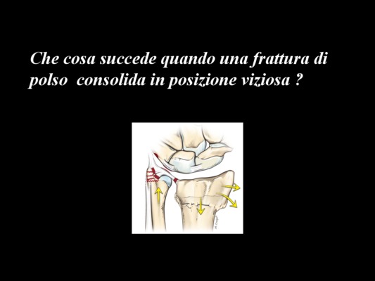 polso Book
