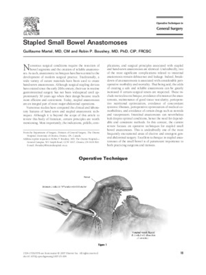 small bowel obstruction band Book