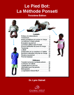 methode de ponseti Book