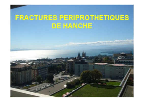 fractures de la hanche Book