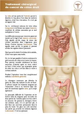 angioplastie persomed Book