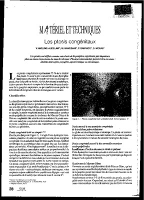 extra oculaires Book
