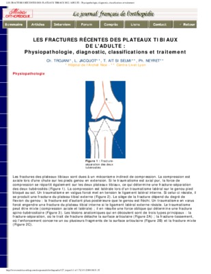 fractures recentes des plateaux tibiaux Book
