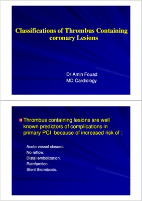 coronary desease Book