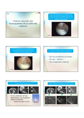 thomazeau Book